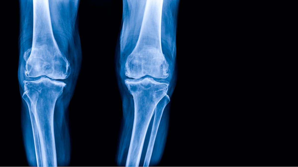 Robotics-assisted orthopaedic surgery